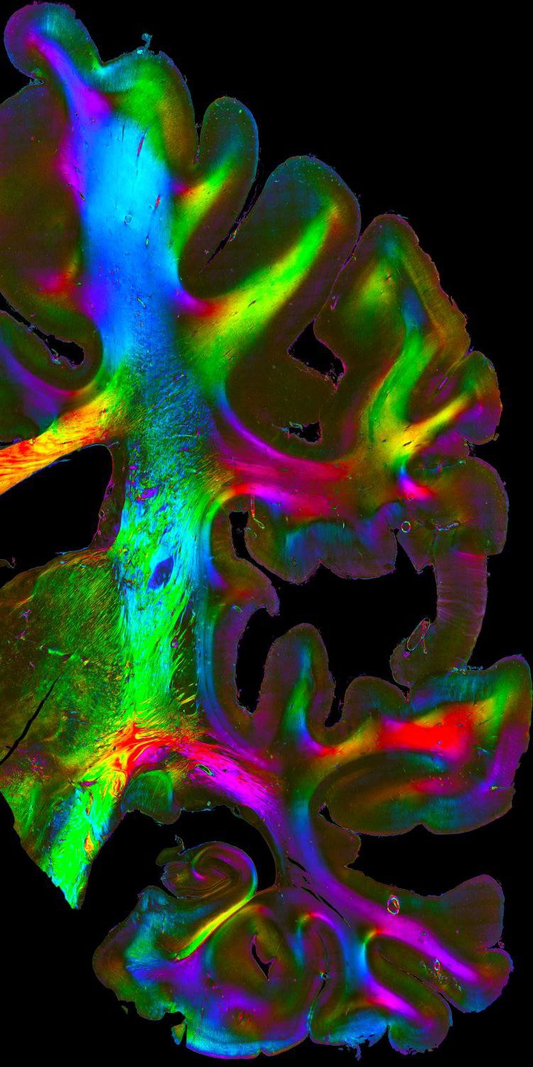 Nervenfasern im menschlichen Gehirn